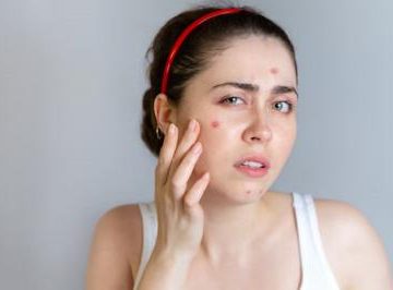 damaged-skin-because-of-fake-skincare-this-is-the-first-aid-step.jpg Damaged Skin because of Fake Skincare? This is the First Aid Step